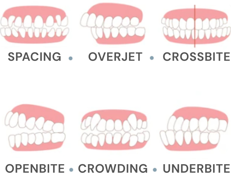 Conditions That Benefit From Phase I Treatment